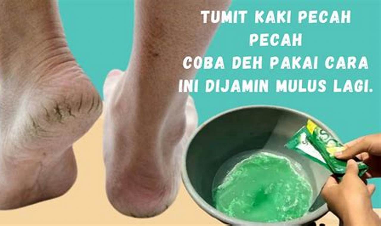 Cara Mengatasi Tumit Pecah Pecah